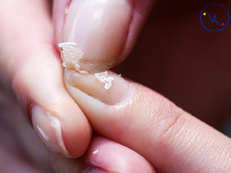 Cách chăm sóc móng khỏe mạnh 2