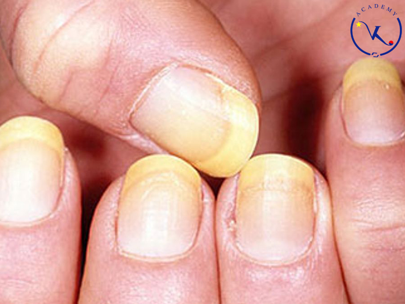 Cách chăm sóc móng khỏe mạnh 3